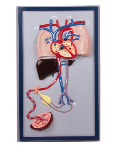 Erler Zimmer, modello anatomico di arteriosclerosi, in 4 sezioni G265 Erler Zimmer, modello anatomico di arteriosclerosi, in 4 sezioni G265