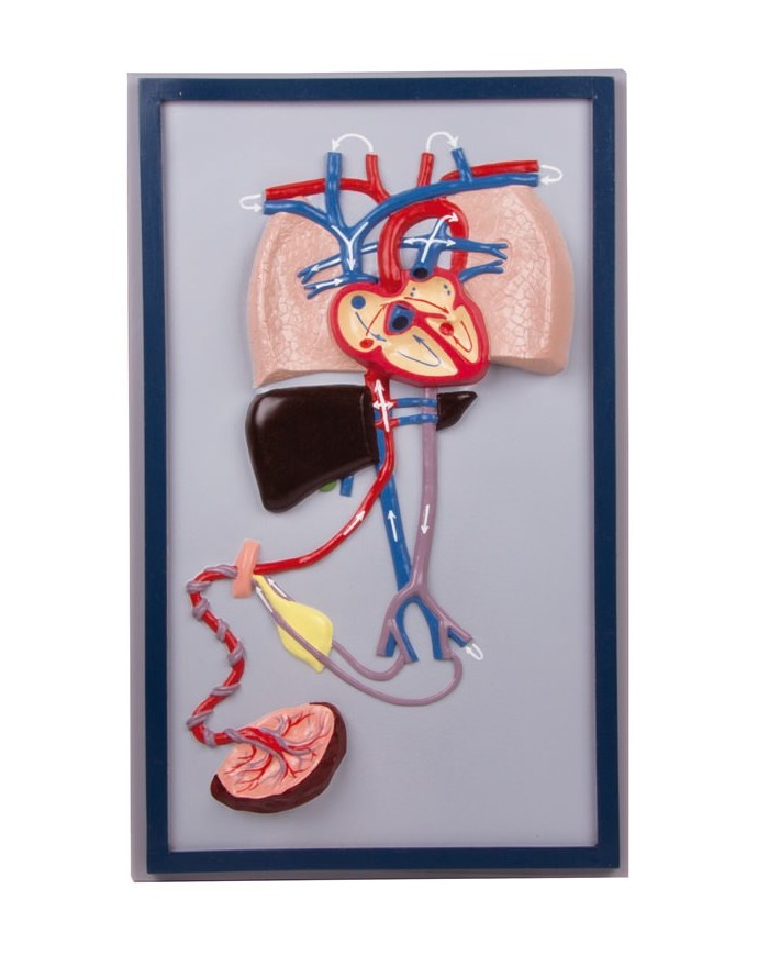 Erler Zimmer, modello anatomico di arteriosclerosi, in 4 sezioni G265