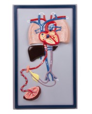 Erler Zimmer, modello anatomico di arteriosclerosi, in 4 sezioni G265