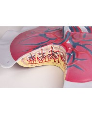 Erler Zimmer, modello anatomico di arteriosclerosi, in 4 sezioni G265