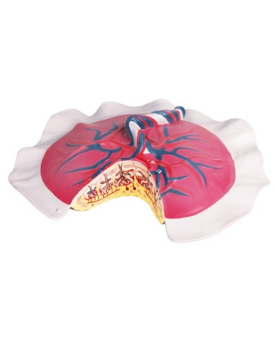 Erler Zimmer, modello anatomico di arteriosclerosi, in 4 sezioni G265 Erler Zimmer, modello anatomico di arteriosclerosi, in 4 sezioni G265