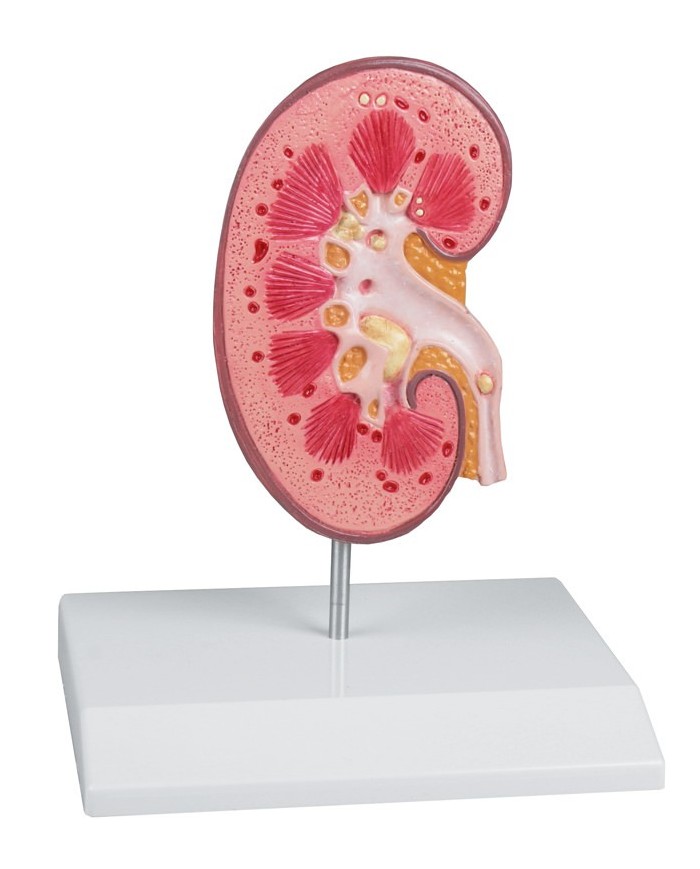 Erler Zimmer, Modello anatomico didattico di emorroidi K227