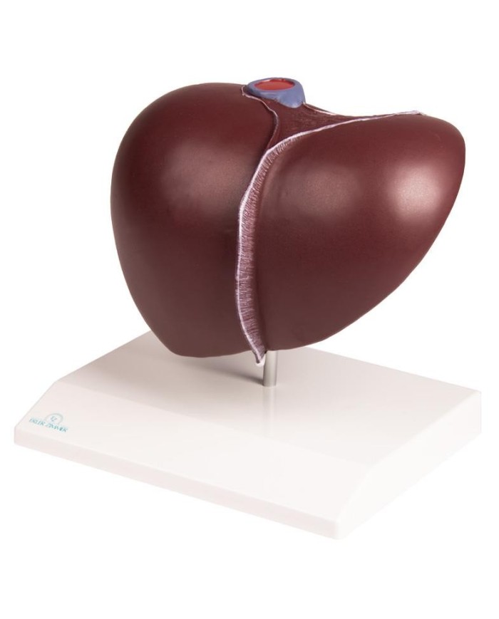 Erler Zimmer, Modello di patologie di milza, pancreas e cistifellea K295