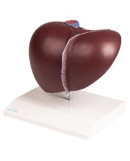 Erler Zimmer, Modello di patologie di milza, pancreas e cistifellea K295