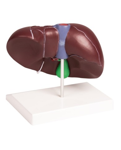 Erler Zimmer, Modello di patologie di milza, pancreas e cistifellea K295 Erler Zimmer, Modello di patologie di milza, pancreas e cistifellea K295