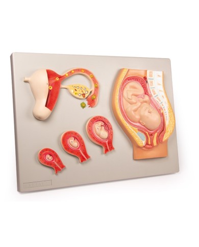 Erler Zimmer, modello anatomico di utero a grandezza naturale L261 Erler Zimmer, modello anatomico di utero a grandezza naturale L261