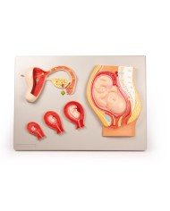 Erler Zimmer, modello anatomico di utero a grandezza naturale L261