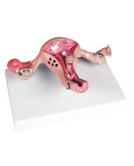 Erler Zimmer, modello anatomico di utero a grandezza naturale L261