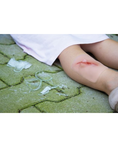 Moulage e simulazione di ferita con taglio da scheggia di vetro Erler Zimme