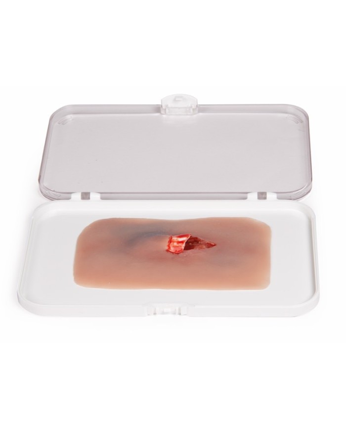 Moulage e simulazione di ferita da frattura esposta Erler Zimmer NW004