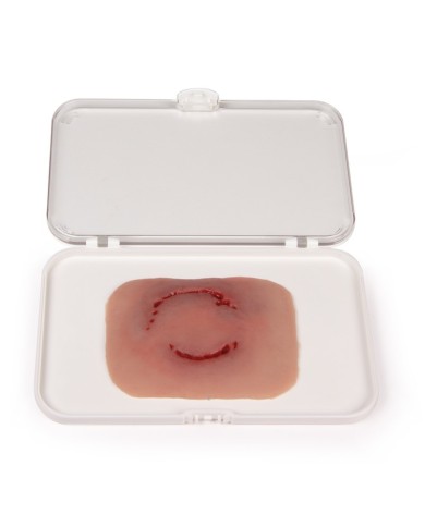 Moulage e simulazione di ferita da morso causata da un essere umano Erler Z