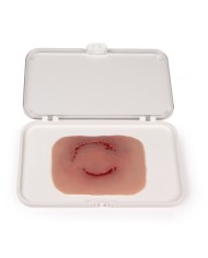 Moulage e simulazione di ferita da morso causata da un essere umano Erler Z