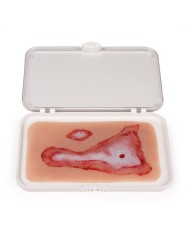 Moulage e simulazione di ferita da scottatura Erler Zimmer NW011