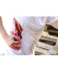 Moulage e simulazione di ampia lacerazione con funzione di sanguinamento Er