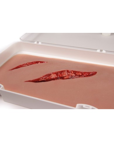 Moulage e simulazione di ampia lacerazione con funzione di sanguinamento Er