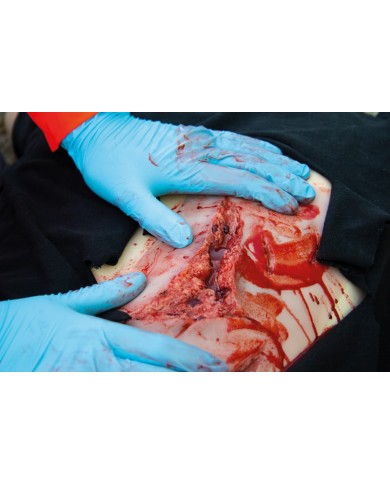 Moulage e simulazione di ampia lacerazione con lacerazioni minori con funzi