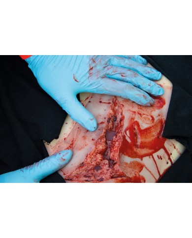 Moulage e simulazione di ampia lacerazione con lacerazioni minori con funzi