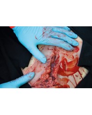 Moulage e simulazione di ampia lacerazione con lacerazioni minori con funzi