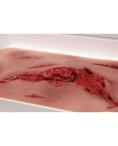 Moulage e simulazione di ampia lacerazione con lacerazioni minori con funzi