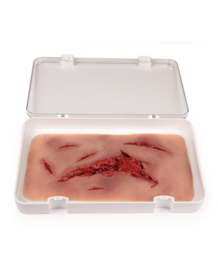 Moulage e simulazione di ampia lacerazione con lacerazioni minori con funzi