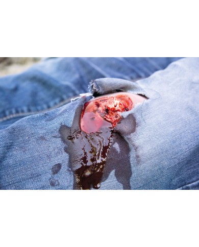 Moulage e simulazione di ferita della gamba con frattura esposta e funzione