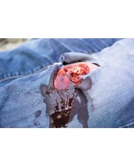 Moulage e simulazione di ferita della gamba con frattura esposta e funzione