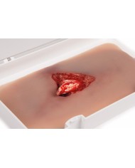Moulage e simulazione di ferita della gamba con frattura esposta e funzione