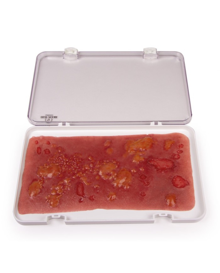 Moulage e simulazione di ustione di secondo grado Erler Zimmer NW106