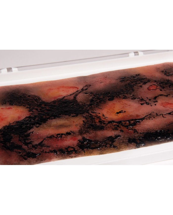 Moulage e simulazione di ustione di terzo grado Erler Zimmer NW107