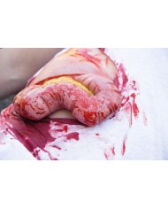 Moulage e simulazione di ferita addominale con protrusione dell intestino E