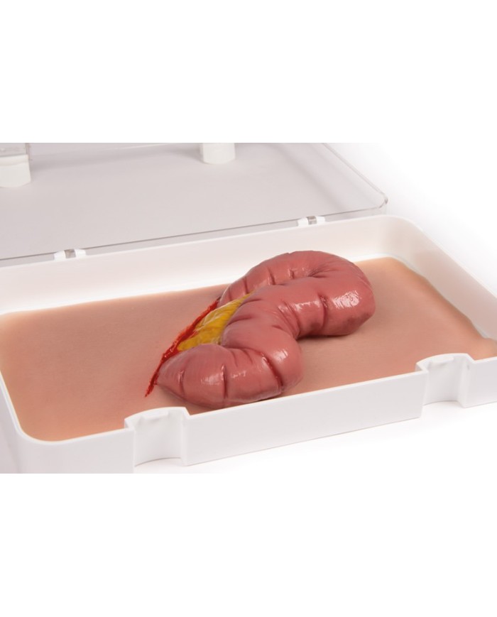 Moulage e simulazione di ferita addominale con protrusione dell intestino E