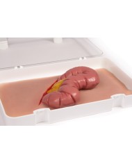 Moulage e simulazione di ferita addominale con protrusione dell intestino E