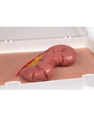 Moulage e simulazione di ferita addominale con protrusione dell intestino E
