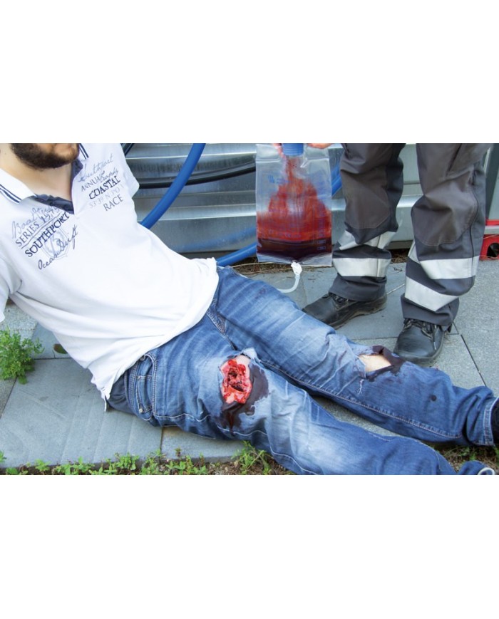 Moulage e simulazione di ferita con ampio sanguinamento per medicazione Erl