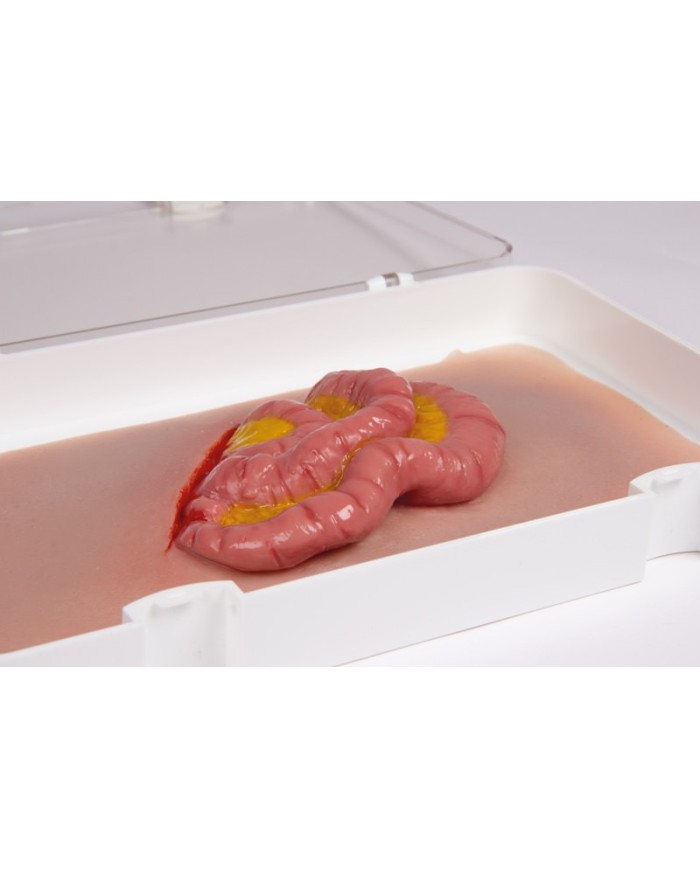 Moulage e simulazione di ferita addominale con protrusione dell intestino t