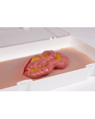 Moulage e simulazione di ferita addominale con protrusione dell intestino t