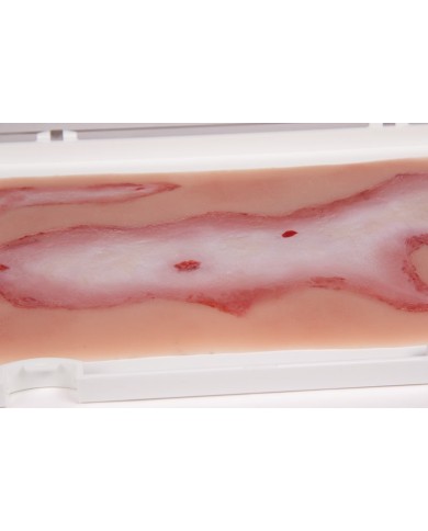 Moulage e simulazione di ferita da scottatura Erler Zimmer NW108