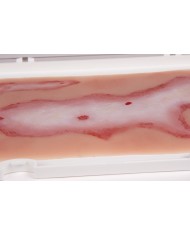 Moulage e simulazione di ferita da scottatura Erler Zimmer NW108