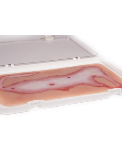 Moulage e simulazione di ferita da scottatura Erler Zimmer NW108