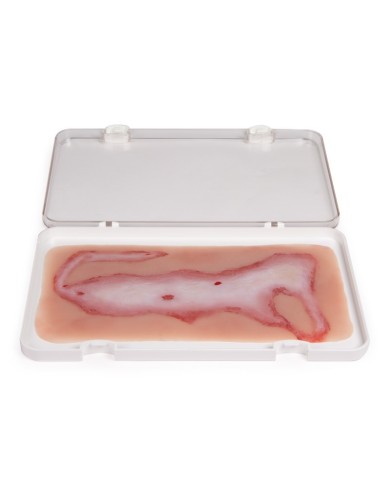 Moulage e simulazione di ferita da scottatura Erler Zimmer NW108