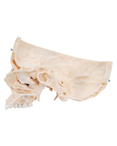 3B Scientific Cranio BONElike