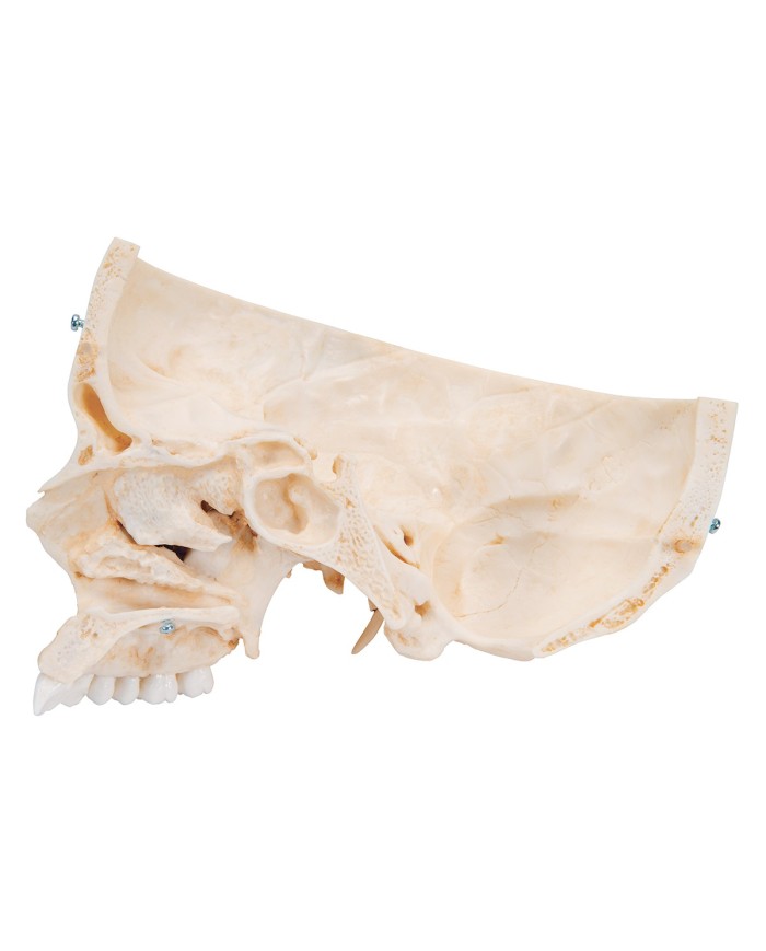 3B Scientific Cranio BONElike