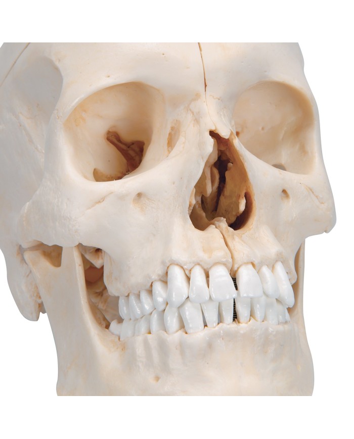 3B Scientific Cranio BONElike