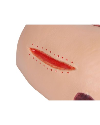 Simulatore di ulcere da decubito EZ 7600