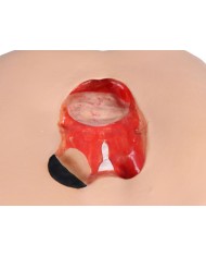 Simulatore di ulcere da decubito EZ 7600