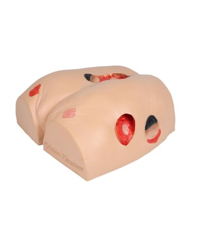 Simulatore di ulcere da decubito EZ 7600