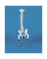 Erler Zimmer, Colonna vertebrale per la dimostrazione di malformazioni con bacino e tronchi dei femori