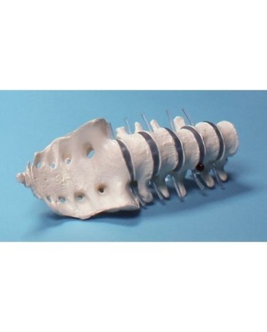 Erler Zimmer, modello anatomico di colonna vertebrale lombare Erler Zimmer, modello anatomico di colonna vertebrale lombare