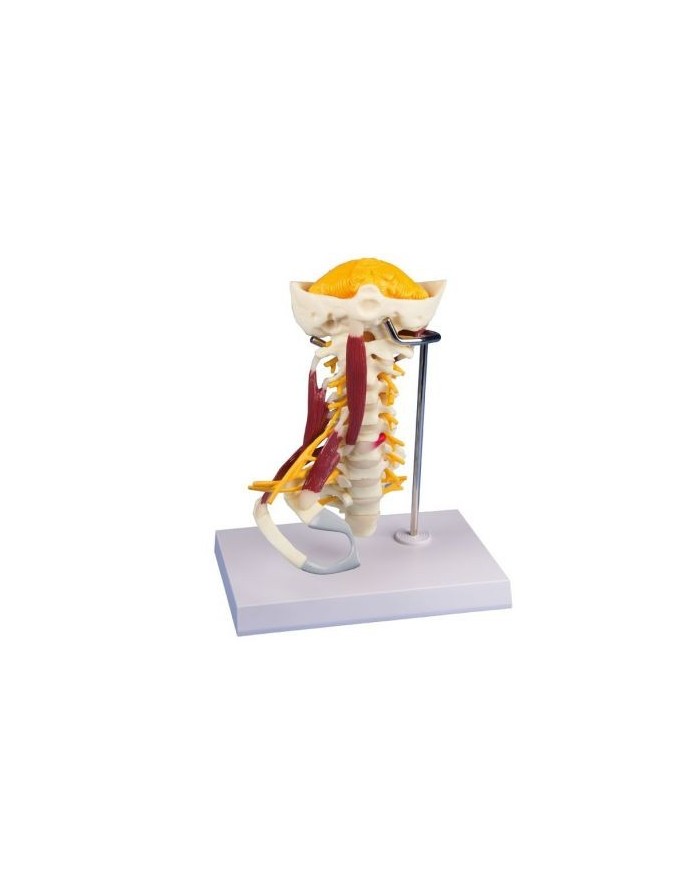 Erler Zimmer, modello anatomico di colonna vertebrale cervicale con muscoli e osso occipitale
