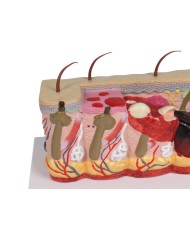 Modello di pelle patologica con ustioni ingrandita 30 volte Erler Zimmer E